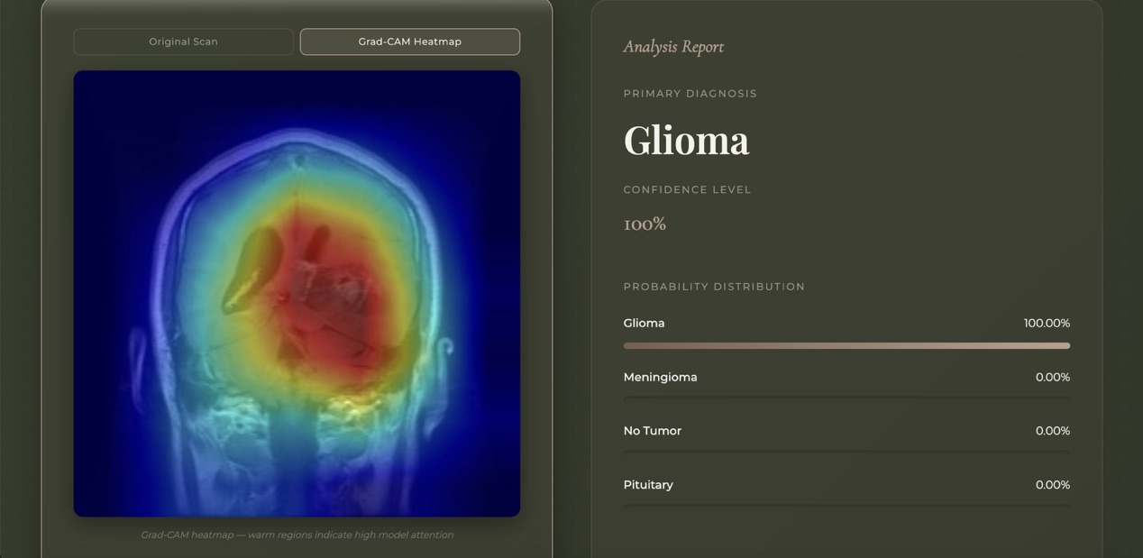 Brain Tumor MRI Multi-Class Classifier